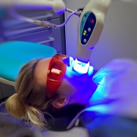 Wybielanie gabinetowe - lampa